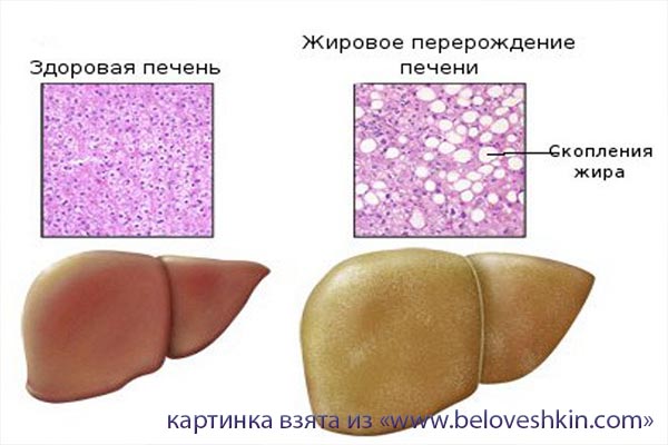 лишний вес при беременности как похудеть лишний вес при беременности как похудеть
